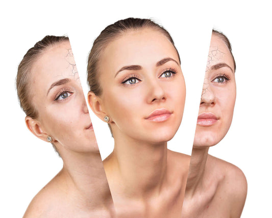 Covering tattoos and skin anomalies