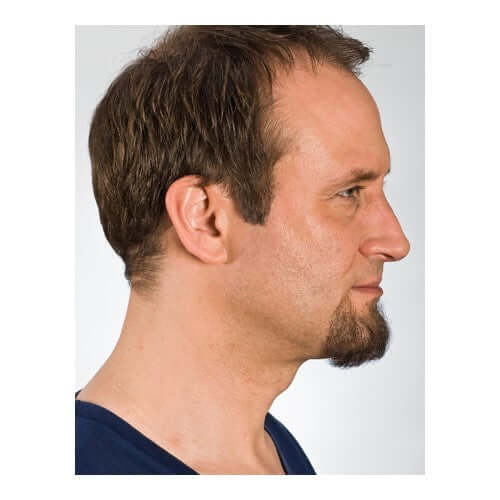 Chin beard short side view