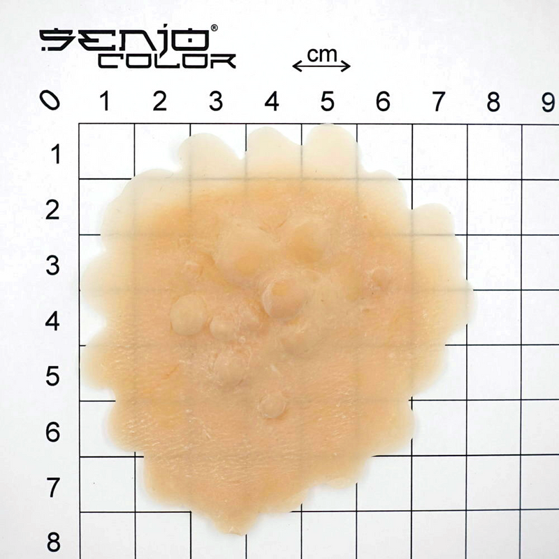 Plague bumps latex application with dimensions