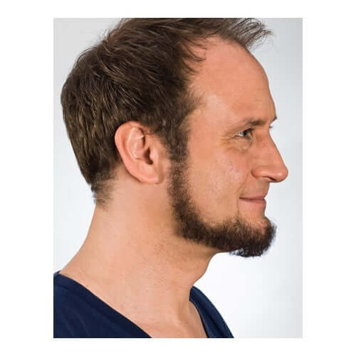 Full beard angular side view