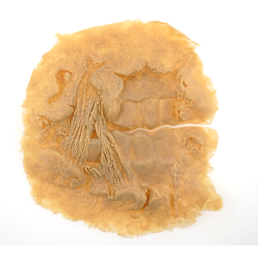 open cheek latex application