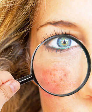 Camouflage MakeUp Anwendungstipps