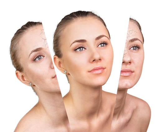 Covering tattoos and skin anomalies