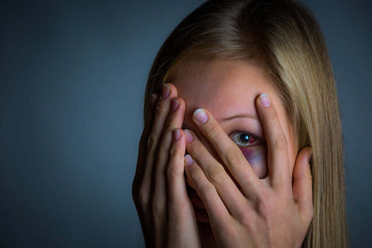 blaues Auge was nun? überschminken