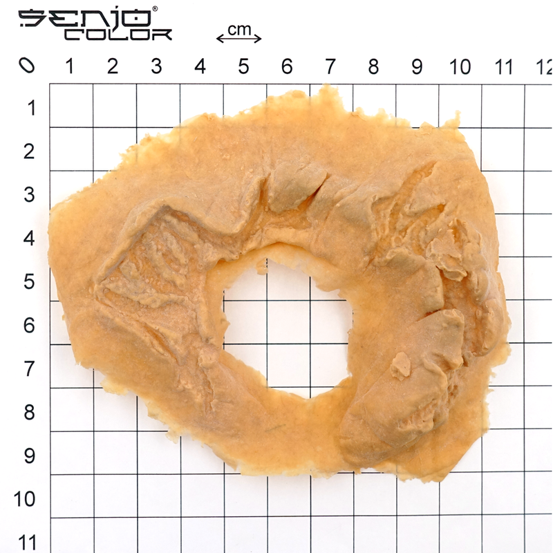 Eye injury size chart