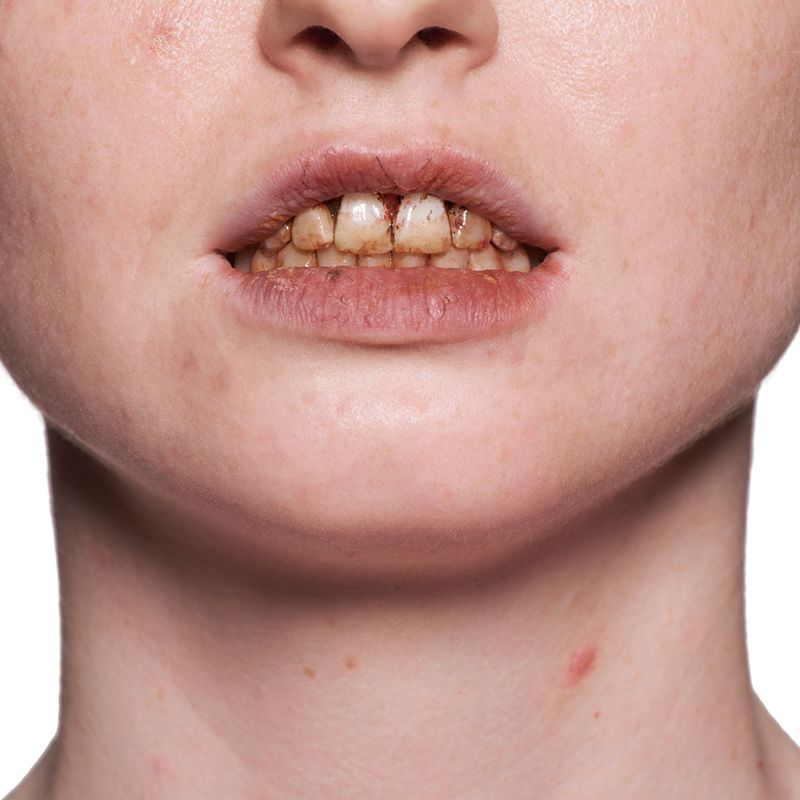 Tooth varnish colored in the 12ml brush bottle - view 1 
