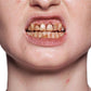 Tooth varnish colored in the 12ml brush bottle - view 2